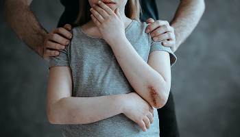Abuse and Neglect